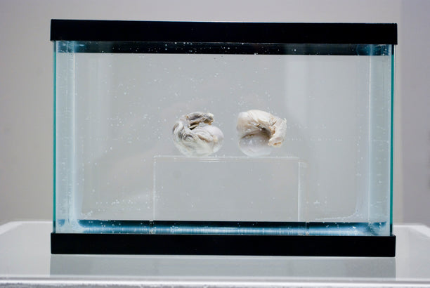 Image for blog post entitled "We have to think intersectionally"—Yishay Garbasz on the politics of allyship and solidarity